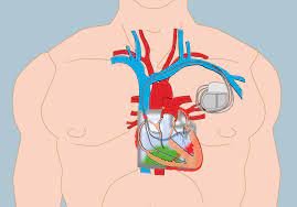 Urgências Cardiovasculares